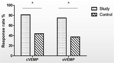 Influence of Cochlear Implantation on Vestibular Function in Children With an Enlarged Vestibular Aqueduct